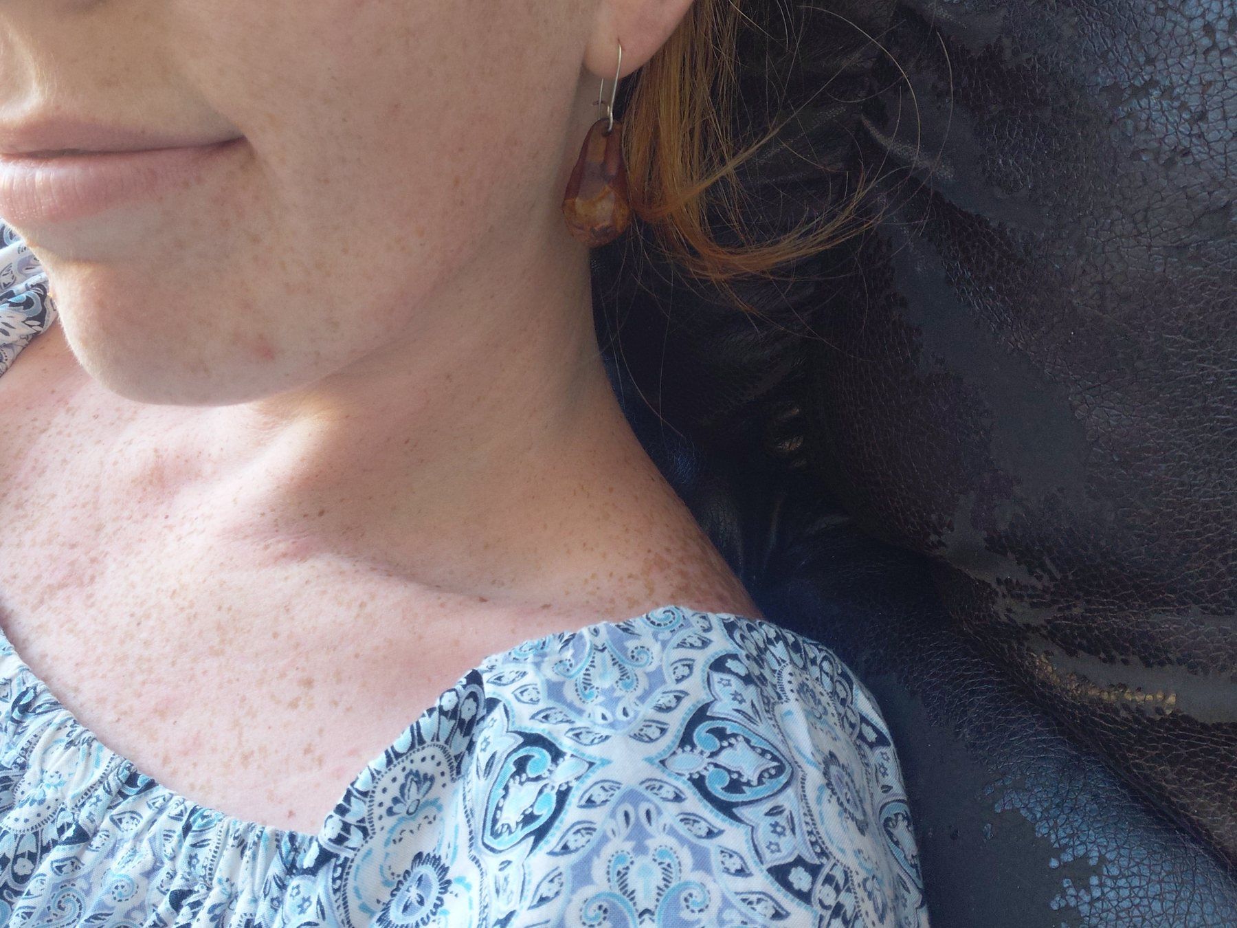 Pine Cone Earrings